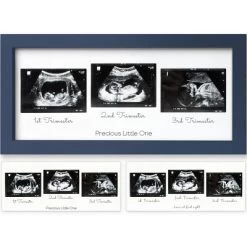 KeaBabies Trio Baby Sonogram Picture Frame, Baby Ultrasound Picture Frames For Baby Nursery, Mom To Be Gifts -Art Wall Deals Store GUEST 0d39649d 6126 4bba b217 1b917313aa7c