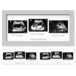 KeaBabies Trio Baby Sonogram Picture Frame, Baby Ultrasound Picture Frames For Baby Nursery, Mom To Be Gifts -Art Wall Deals Store GUEST 3bf25d41 c634 498c 84e3 c83dfec65ad0