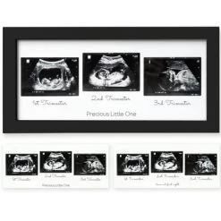 KeaBabies Trio Baby Sonogram Picture Frame, Baby Ultrasound Picture Frames For Baby Nursery, Mom To Be Gifts -Art Wall Deals Store GUEST 692bd1b8 56a8 4616 9d57 d9c4204c1c6d