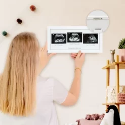 KeaBabies Trio Baby Sonogram Picture Frame, Baby Ultrasound Picture Frames For Baby Nursery, Mom To Be Gifts -Art Wall Deals Store GUEST 8c381fde f5ad 4288 ad1a 438da1868f74