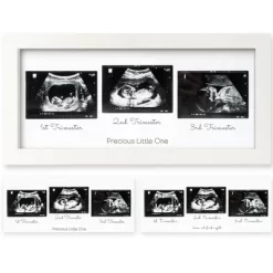 KeaBabies Trio Baby Sonogram Picture Frame, Baby Ultrasound Picture Frames For Baby Nursery, Mom To Be Gifts -Art Wall Deals Store GUEST c8d682a4 195b 4175 a0a5 f4e027afd6f2
